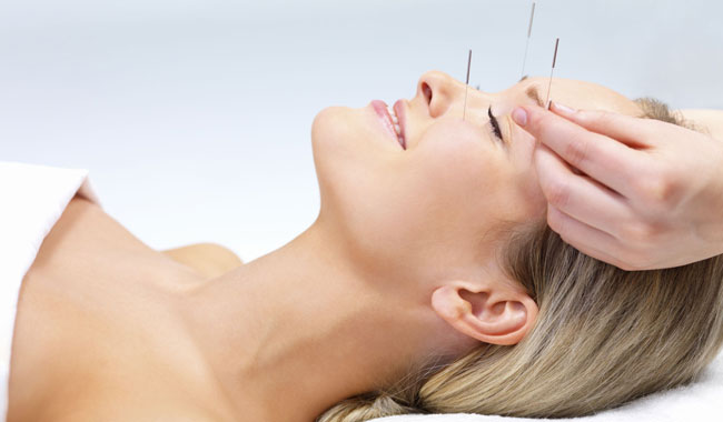 Acupuncture-1.jpg